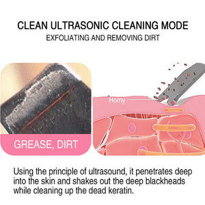 Ultrasonic Atomizing Skin Scrubber Blackhead Acne Remover Heating Deep Cleansing Facial Peeling Shovel Face Clean Skin Care（DYM-013）