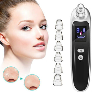 Electric blackhead remover