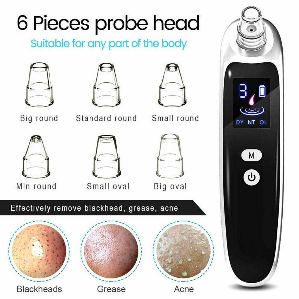 Electric blackhead remover