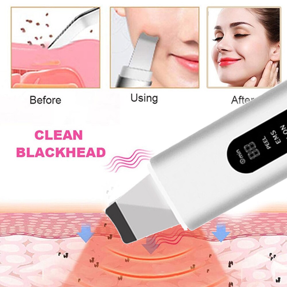 Ultrasonic Atomizing Skin Scrubber Blackhead Acne Remover Heating Deep Cleansing Facial Peeling Shovel Face Clean Skin Care（DYM-013）