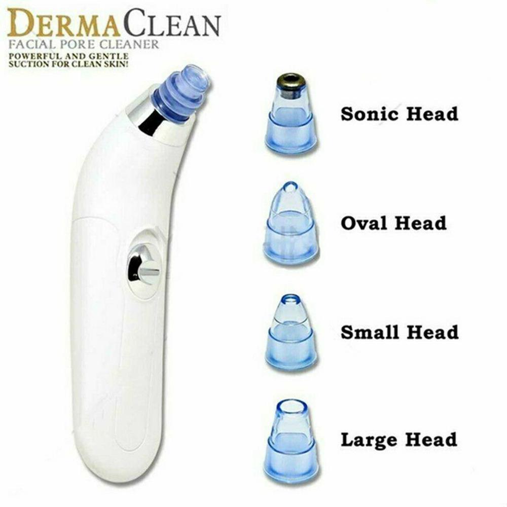 Vacuum Suction Blackhead Remover