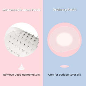 9pcs Translucent Microneedle Pimple Patch Acne Master Treatment Sticker