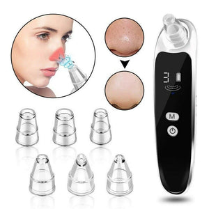 Electric blackhead remover