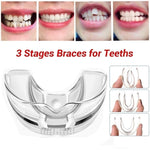 3 Stages Dental Orthodontic Braces Appliance Braces Alignment Trainer Teeth Retainer Bruxism Mouth Guard Teeth Straightener