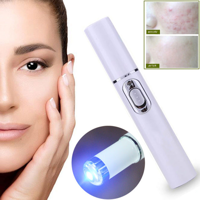 Acne Laser Pen Portable Wrinkle Removal Machine Durable Soft Scar Remover Blue Light Therapy Pen