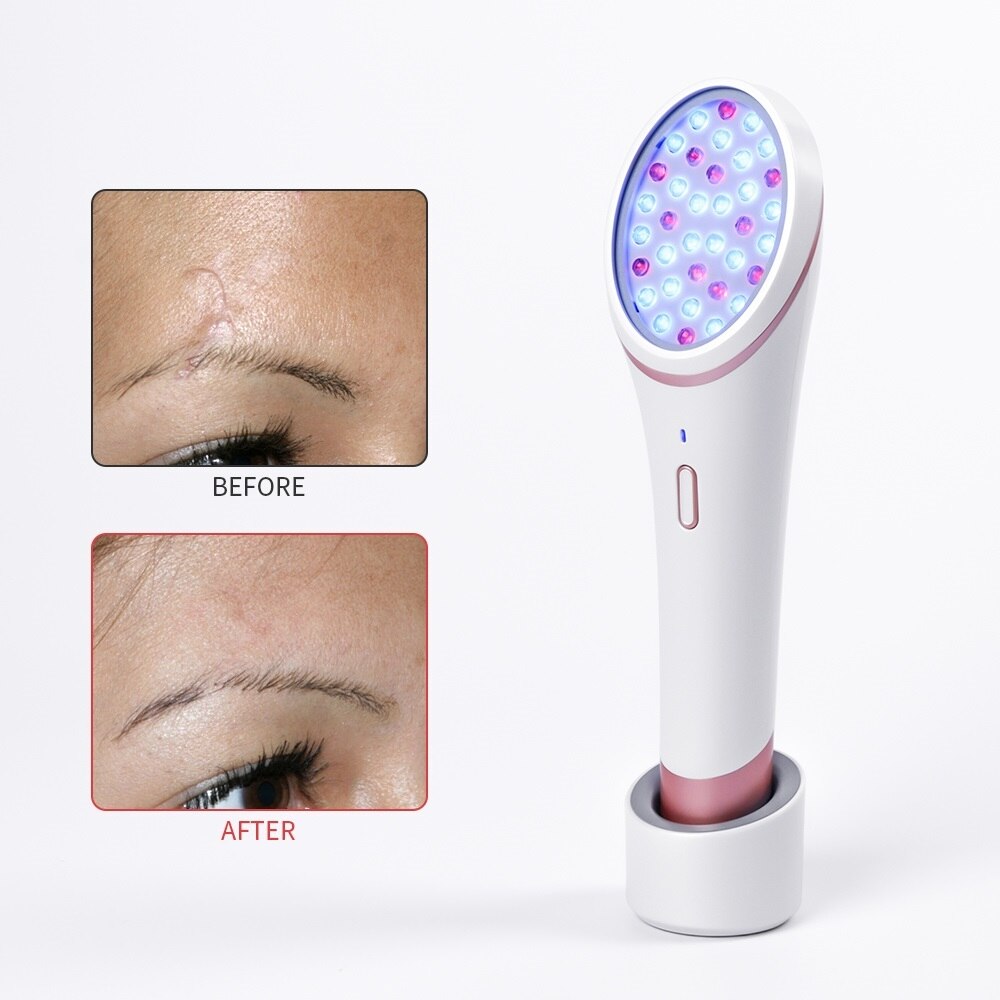 LED Photon Skin Rejuvenation Light Acne